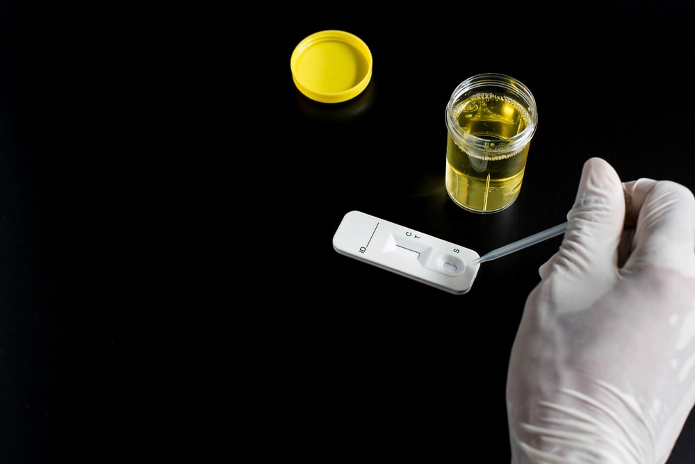 Marijuana urine test